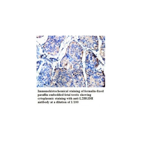  L2HGDH Antibody