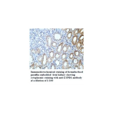  LYPD1 Antibody