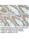 TNFSF11 Antibody