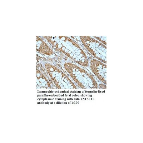  TNFSF11 Antibody