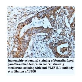 YME1L1 Antibody