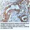 YME1L1 Antibody