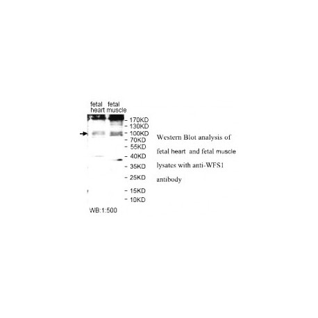  WFS1 Antibody
