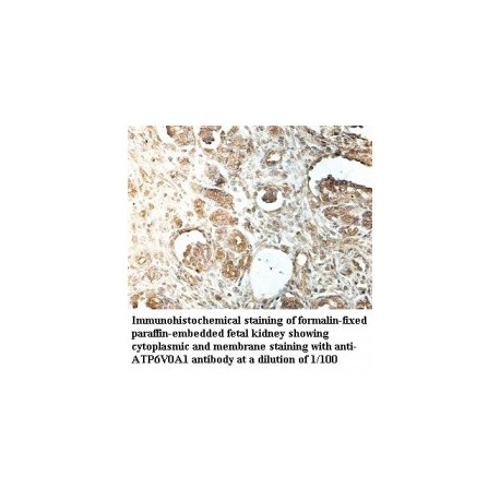  ATP6V0A1 Antibody