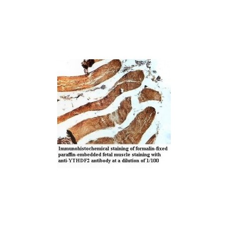 YTHDF2 Antibody