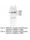  DDX58/RIG-1 Antibody