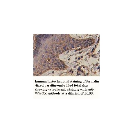  WWOX Antibody