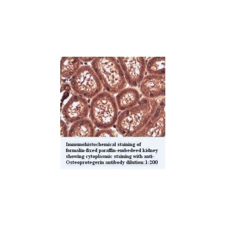  OPG/Osteoprotegerin Antibody