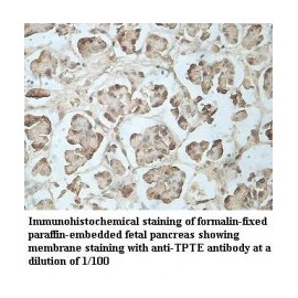  TPTE Antibody
