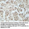 TPTE Antibody