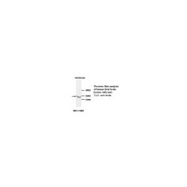 TNFRSF13B Antibody
