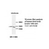 TNFRSF13B Antibody