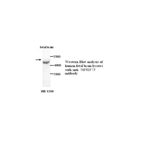  TNFRSF19 Antibody