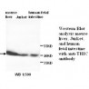 THIC Antibody