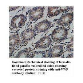 VWF Antibody
