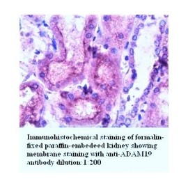 ADAM15 Antibody