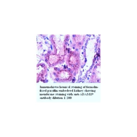 ADAM15 Antibody