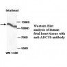 ADCY6 Antibody