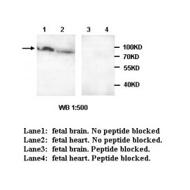 ADCY3 Antibody