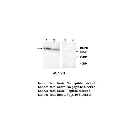 ADCY3 Antibody