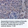 GnT-V Antibody