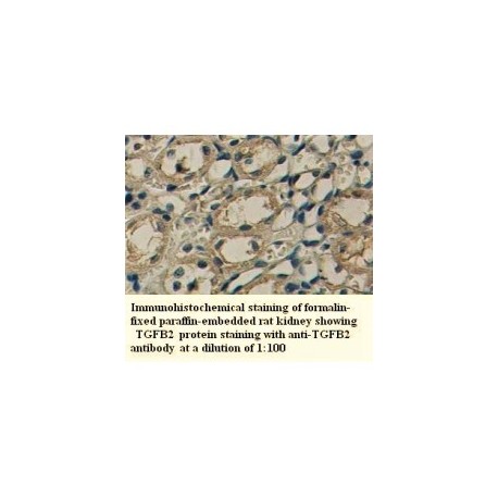 TGFB2 Antibody