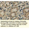 TGFB2 Antibody