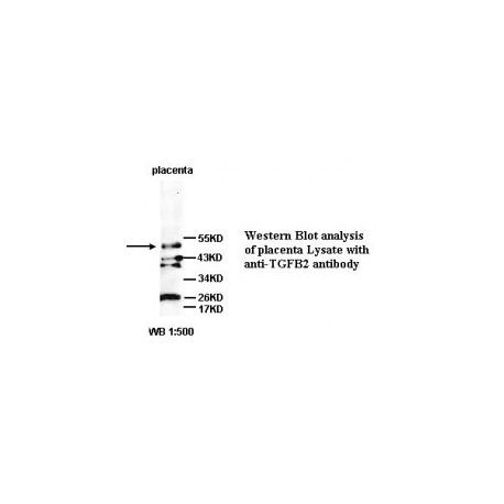 TGFB2 Antibody