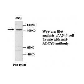 ADCY9 Antibody