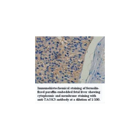 TAOK3 Antibody