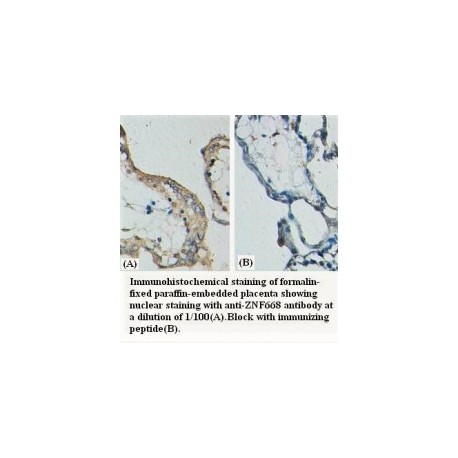 ZNF668 Antibody