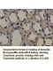 Tumstatin Antibody