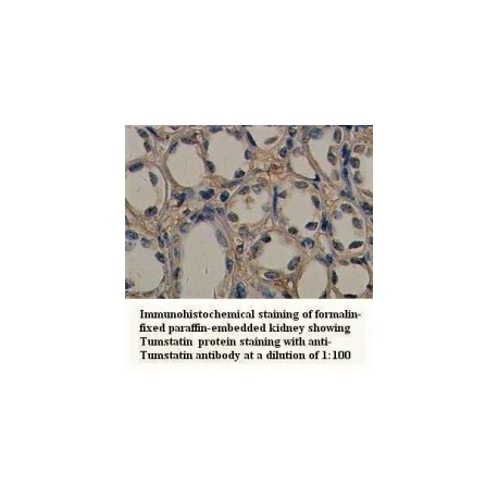 Tumstatin Antibody