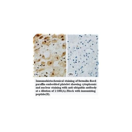 UBB Antibody