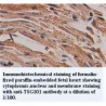 TSG101 Antibody
