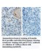 HYAL2 Antibody