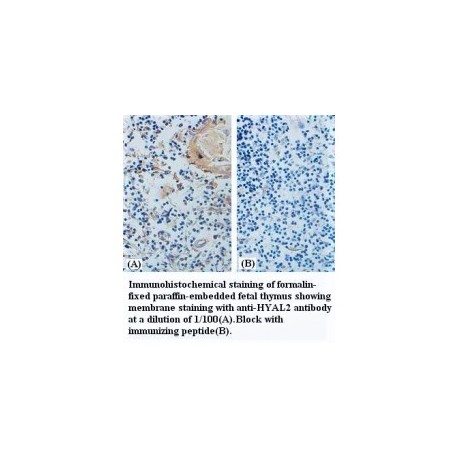 HYAL2 Antibody