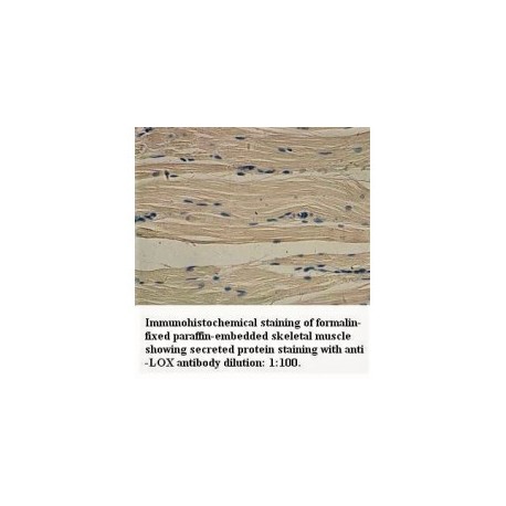 LOX Antibody