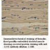LOX Antibody