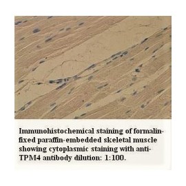 TPM4 Antibody