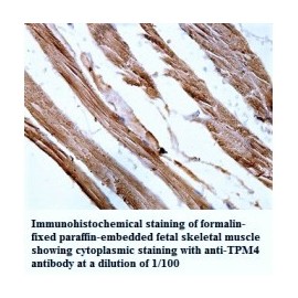 TPM4 Antibody