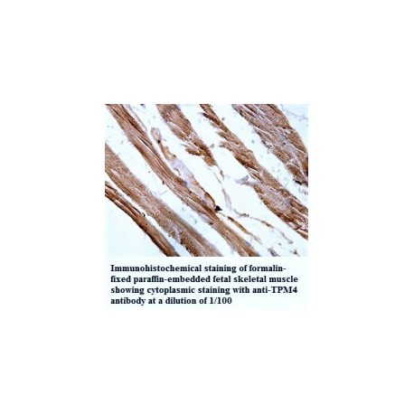 TPM4 Antibody