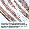 TPM4 Antibody