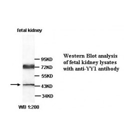 YY1 Antibody