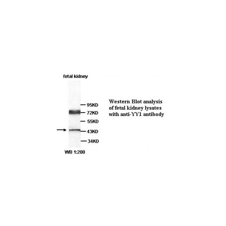 YY1 Antibody