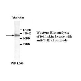 YY1 Antibody