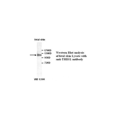 YY1 Antibody