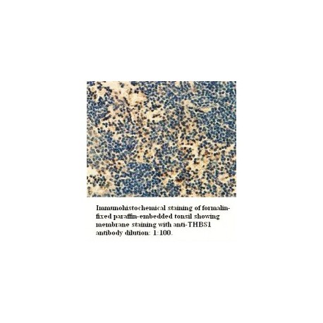 THBS1 Antibody