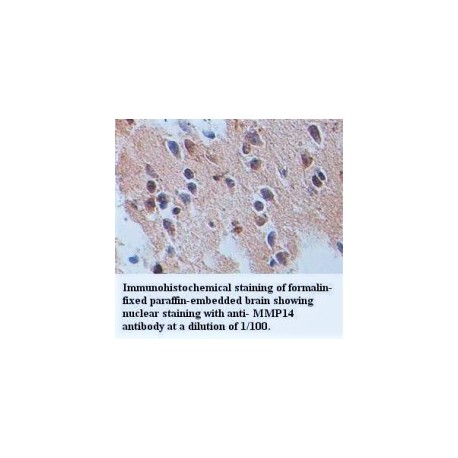 TLE4 Antibody