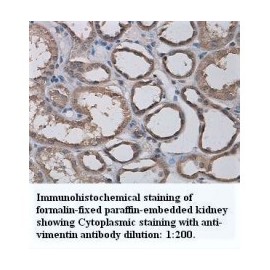 Vimentin Antibody